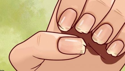 Дефицит марганца: чем это опасно и как справиться. Крепкие ногти и пышные волосы зависят от питания!