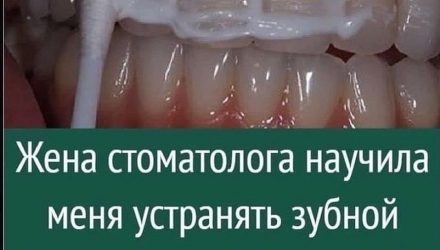 Как отбелить зубы и не нанести им вреда?