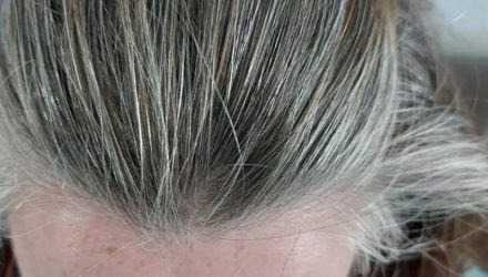Седые волосы: причины и профилактика ранней седины