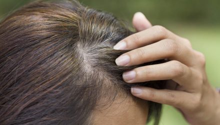 4 основные причины, по которым появляются седые волосы в раннем возрасте, и как этого избежать