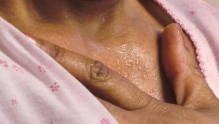 Менопауза у женщин не трагедия: как пережить климакс и сохранить здоровье