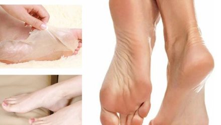 Уксус в носки: проверенный способ для гладких пяток